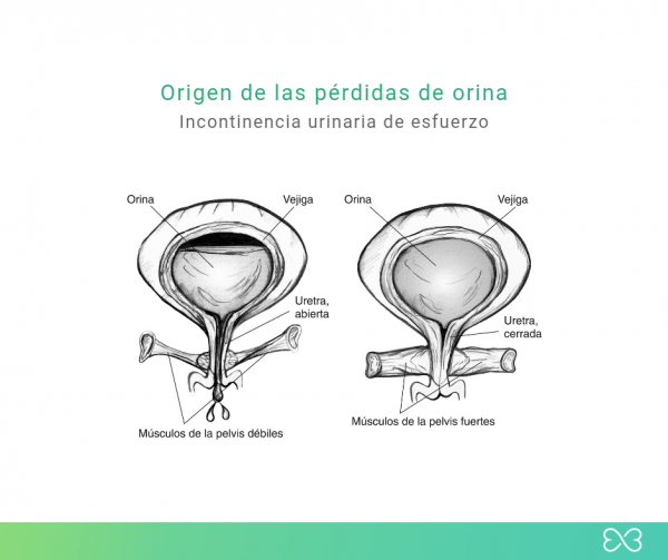 Pérdidas de orina: Olvídate de ellas – Tampsec